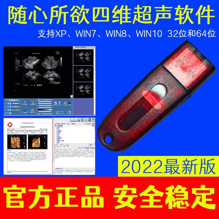 B超工作站软件彩超软件四维超声软件超声天天向尚win7/win10版